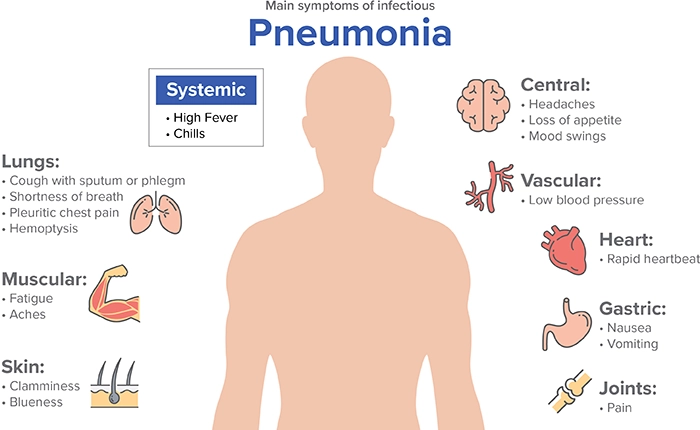 Article Image: pneumonia-and-cpap-therapy