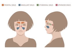 Sinus map